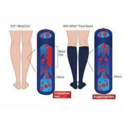 OS1st Travel Compression Over The Calf Socks -Baffin Store DVT Illustration
